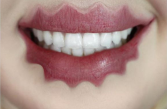 Сумасшедший бьюти-тренд следующего года: волнистые губы! Кто рискнет?