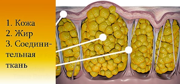 Целлюлит как самый великий всемирный обман