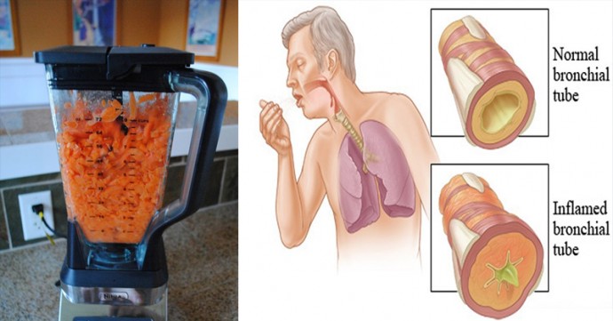 Морковь: избавит от кашля и выведет мокроту из легких!