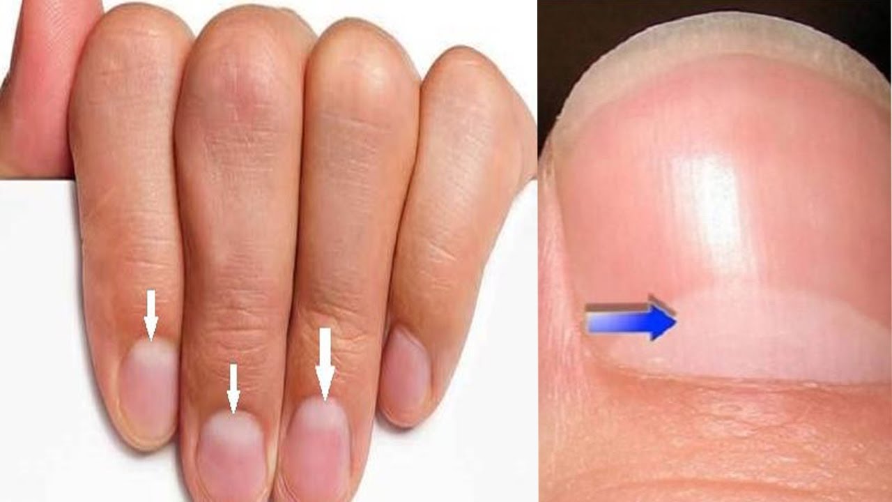 Что ваши ногти могут сказать о вашем здоровье?